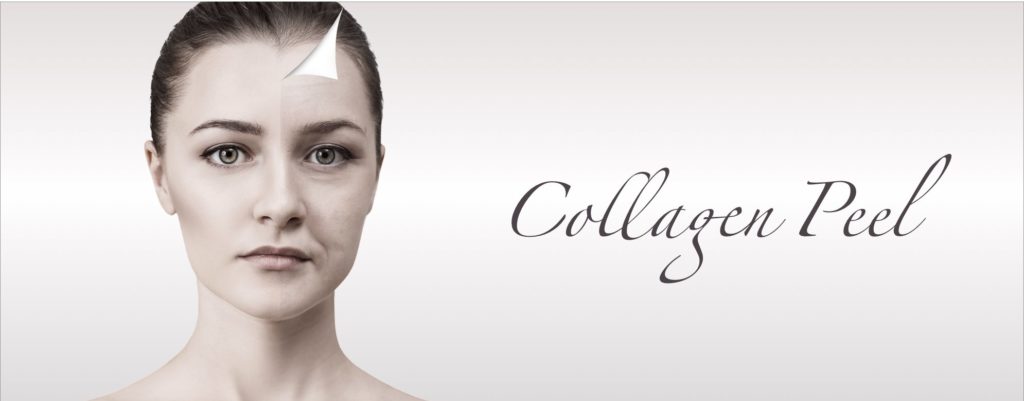 マッサージピール (コラーゲンピール)とは