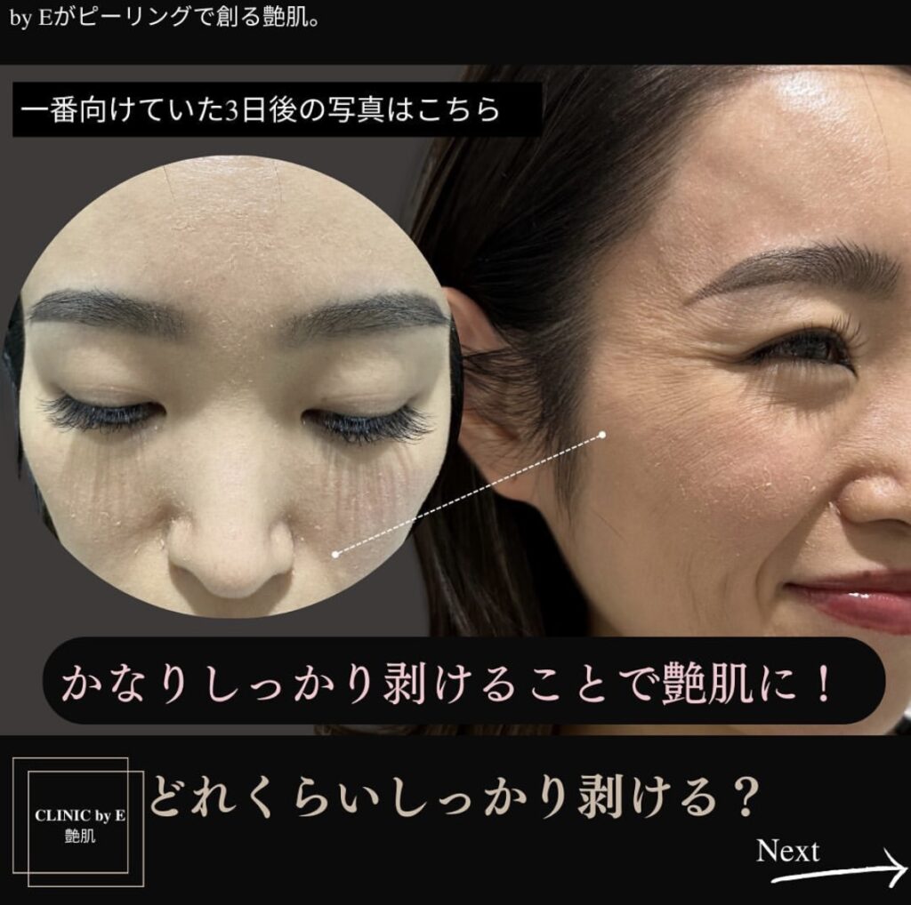 ペパーミントピール