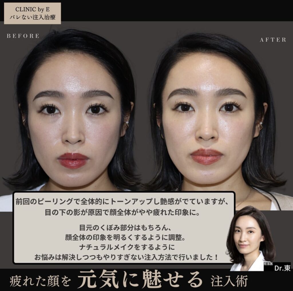 ナチュラル美容