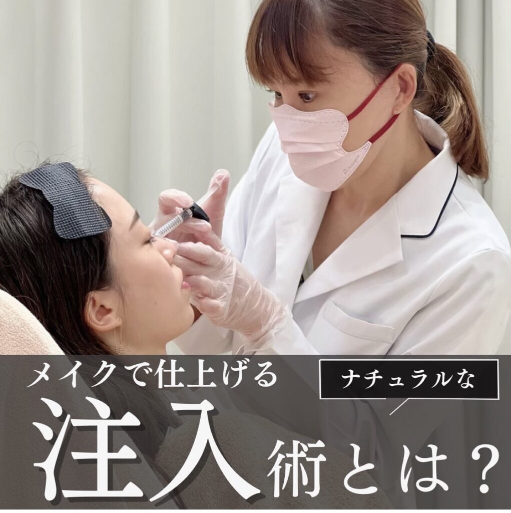 ヒアルロン酸注入