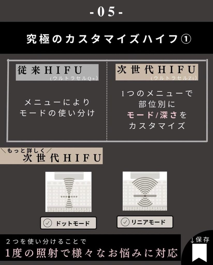 カスタマイズHIFU