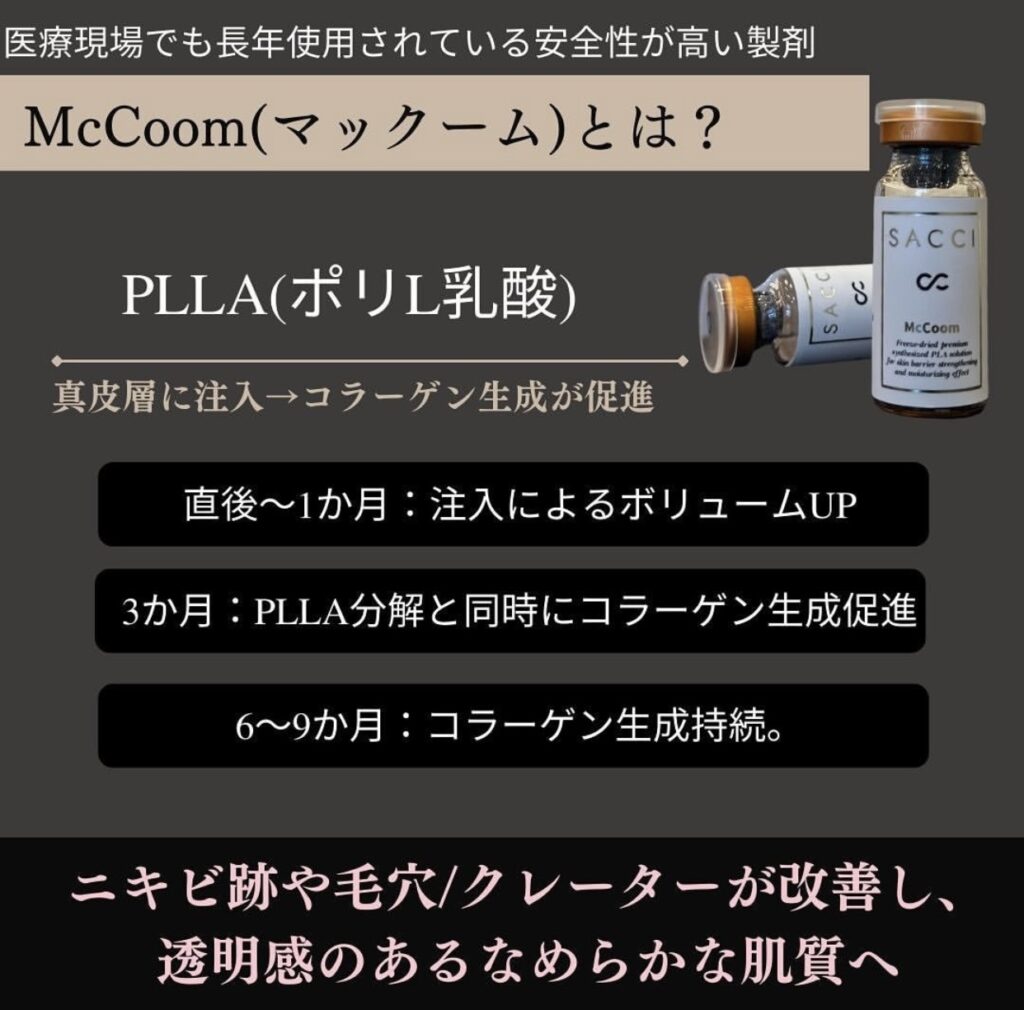 マックームとは