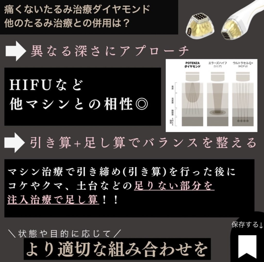 byE式たるみ治療