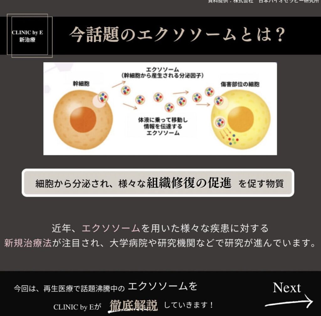 歯髄由来エクソソーム