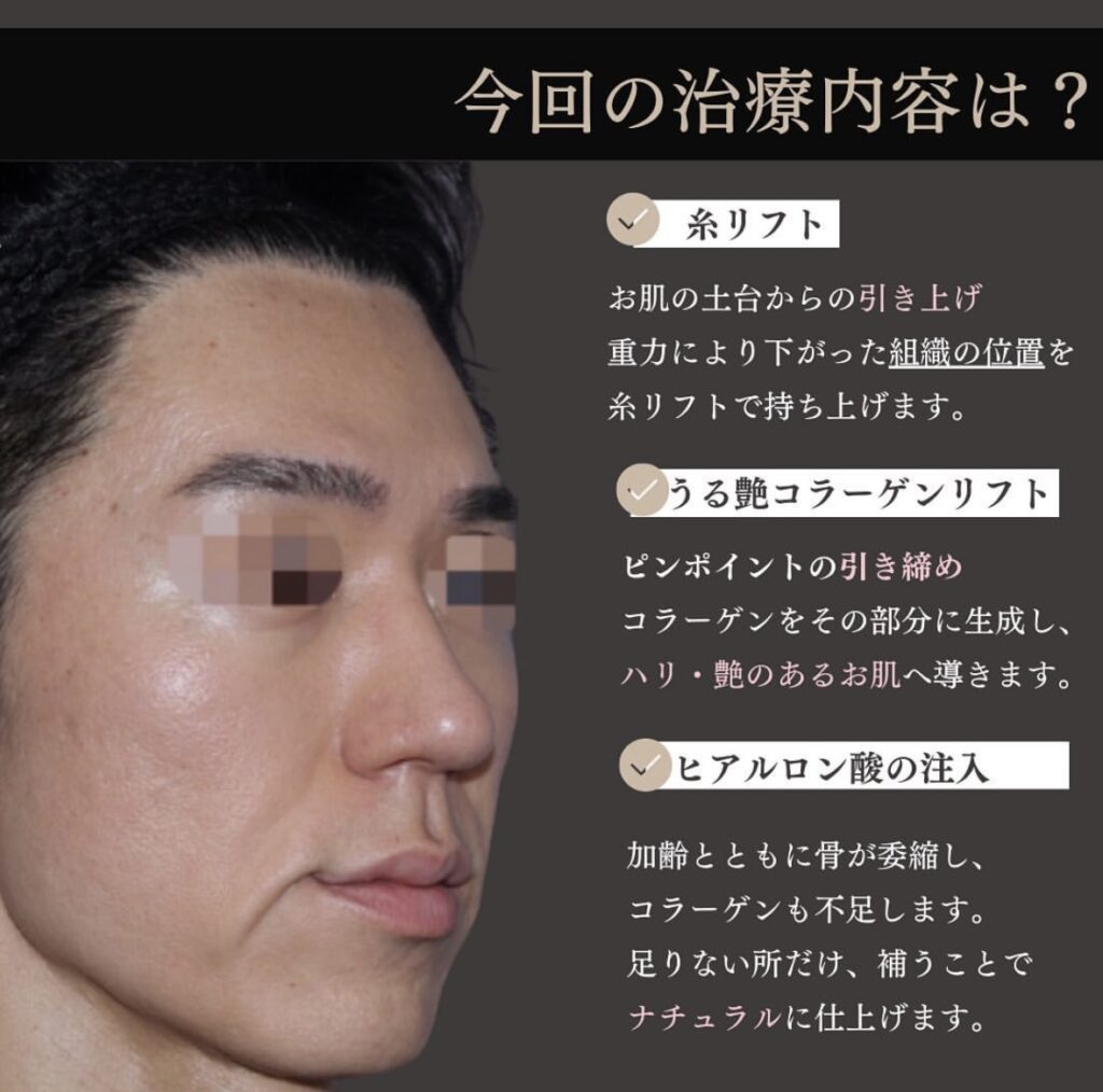 ショッピングスレッド