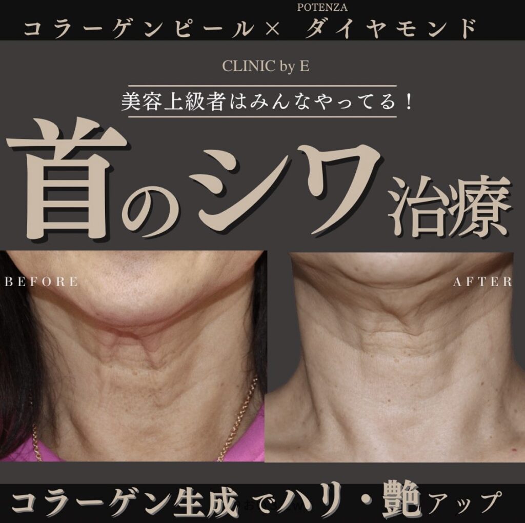 コラーゲンピール