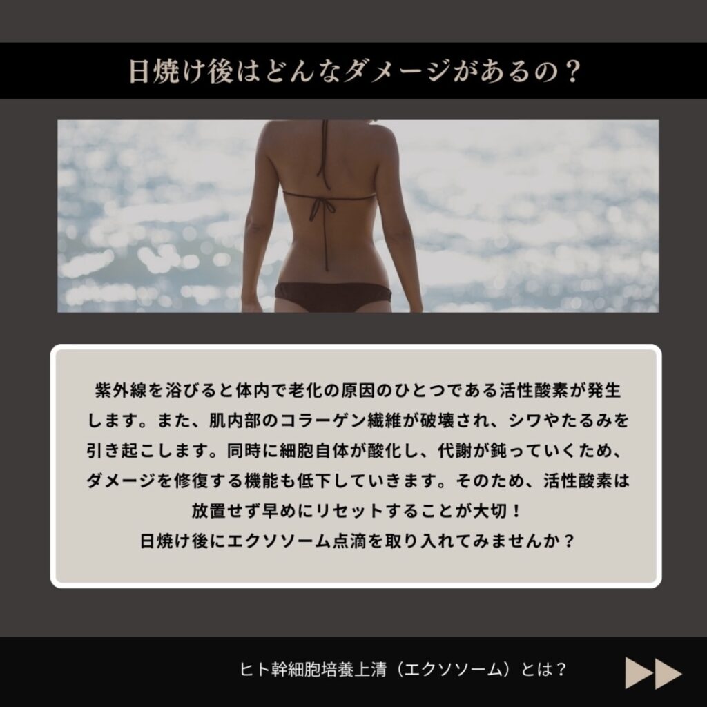 エクソソーム点滴