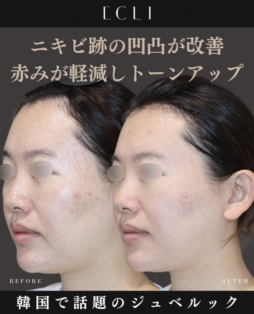 韓国で話題のジュベルック