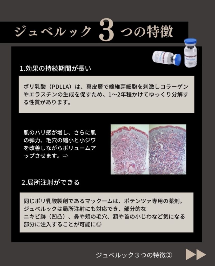 ジュベルック3つの特徴