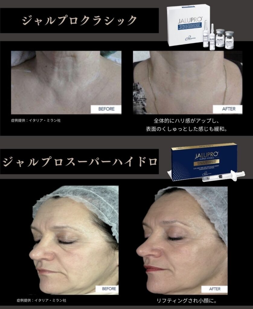 ジャルプロクラシック